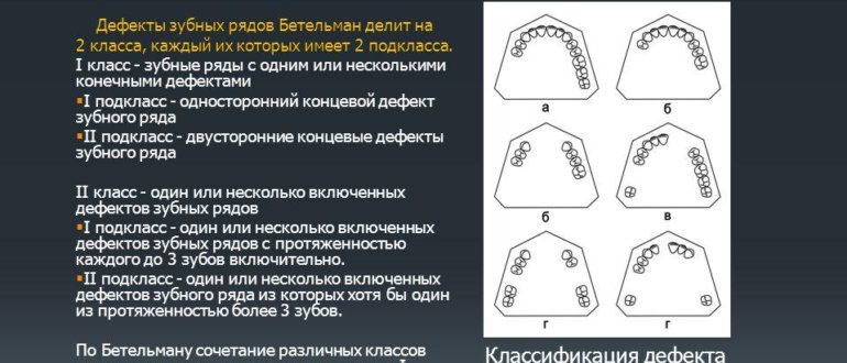 Обследование пациентов с обширными дефектами зубных рядов презентация