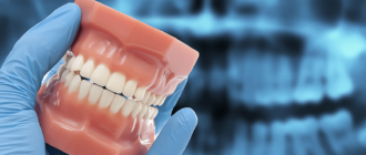 Физиологическое стирание зубов