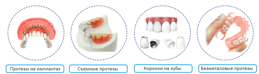 Стоматологическое протезирование зубов. Виды, этапы, способы протезирования.