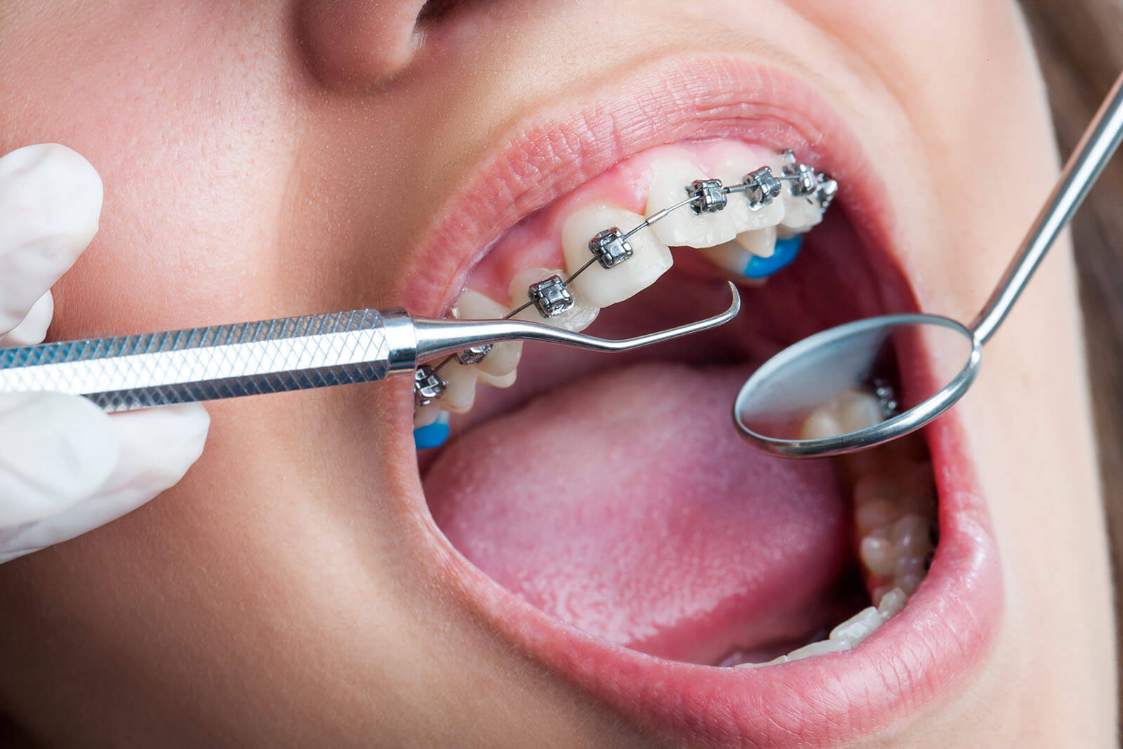 Почему стоит обратиться в Клинику «Зубная фея» при стоматологических проблемах