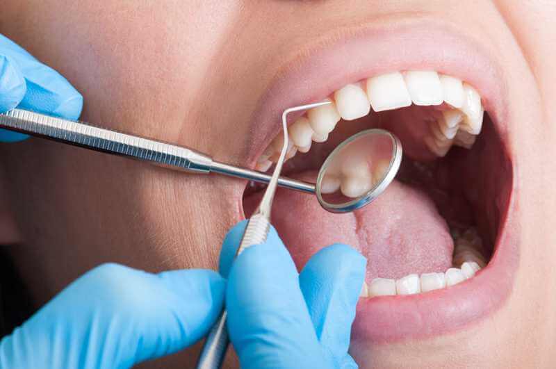 Почему не стоит откладывать лечение зубов?