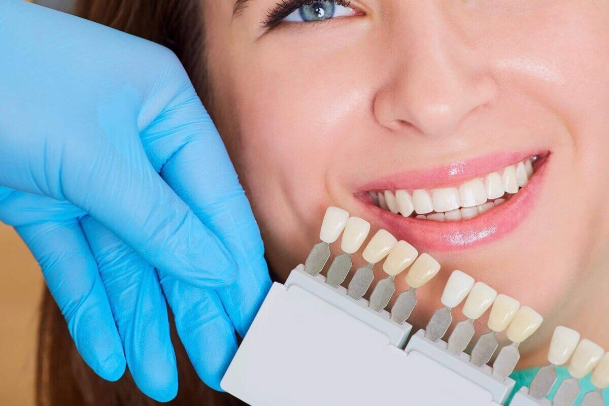 Как получить белоснежную улыбку: все о способах отбеливания зубов
