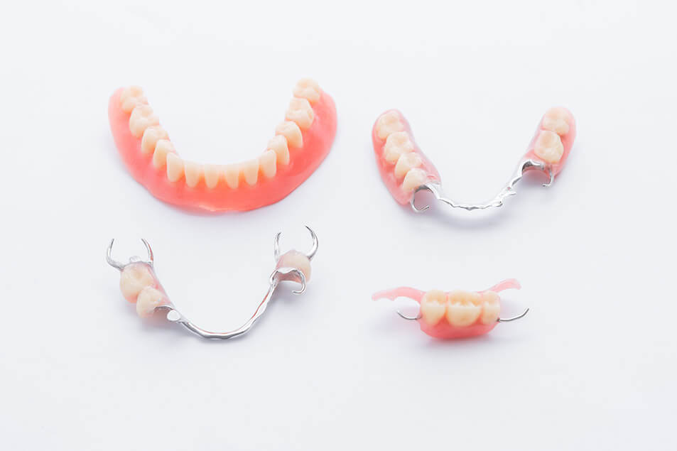 Зубные протезы: восстановление улыбки и качества жизни