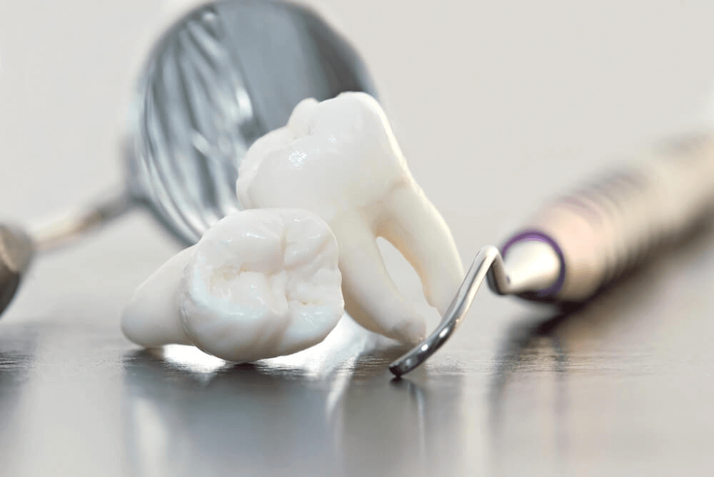 Удаление зуба - стоматолог