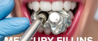Mercury Fillings: Are They Dangerous? Unraveling the Truth Behind Amalgam Dentistry