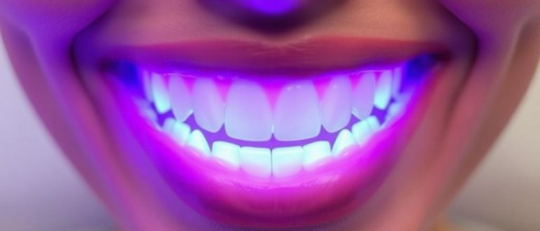 LED Teeth Whitening: Does It Really Work?
