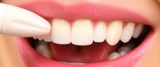 Dental Bonding for Minor Imperfections: A Simple Solution for a Perfect Smile