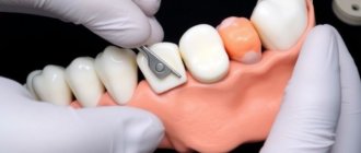 Bone Grafting for Dental Implants: Everything You Need to Know