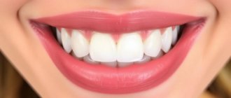Gum Contouring for a Perfect Smile: Everything You Need to Know