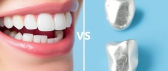 White Fillings vs. Silver Amalgam: Which Dental Filling Is Right for You?