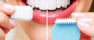 Blanqueamiento dental: ¿vale la pena ir al profesional o probar en casa? Una guía completa para decidir