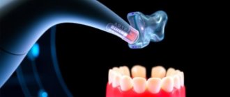 La revolución digital en odontología: CAD/CAM, escáneres intraorales e impresión 3D