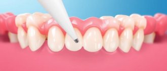 L’importance de la greffe gingivale: Warum Zahnfleischtransplantate in modernen Behandlungen oft den Unterschied machen