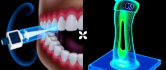 Les nouvelles technologies: Der intraorale Scanner vs. der traditionelle Abdruck — Ein faszinierender Blick in die moderne Zahnmedizin