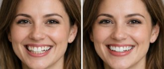 Исправление прикуса: как выбрать путь к ровным зубам без лишнего стресса