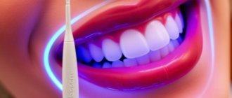 Opalescence дома: как работают системы домашнего отбеливания и что о них важно знать