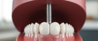 Имплантация зубов в Уфе: как принять взвешенное решение и не ошибиться с выбором