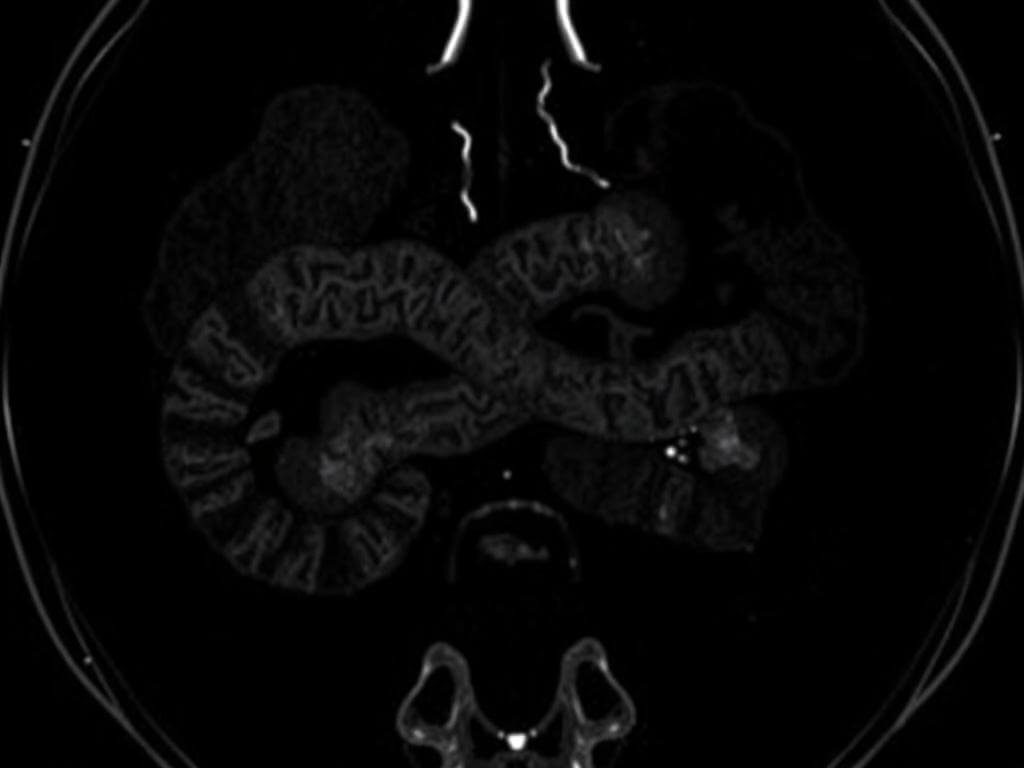 МРТ кишечника: что это за исследование и когда оно действительно нужно