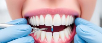 Быстрая имплантация зубов: как получить осмысленную улыбку за короткий срок и когда этого ждать
