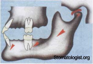 Движения нижней челюсти в сагиттальной и вертикальной плоскостях. 
