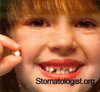 Аномалии развития, прорезывания зубов, изменение их цвета