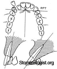 Расположение зубов и размеры зубных дуг.Сагиттальное направление