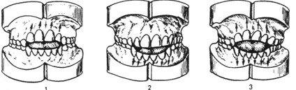 Расположение зубов и размеры зубных дуг.Вертикальное направление