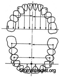 Форма зубных дуг
