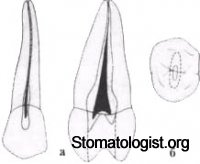 Полость зуба и ее препарирование Часть 2
