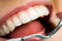 Полость зуба и ее препарирование Часть 3