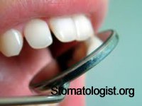 Полость зуба и ее препарирование Часть 4