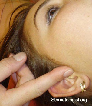 При открытии рта болит ухо. Опухоль на щеке около уха.