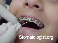 Постановка диагноза.Аномалии зубов