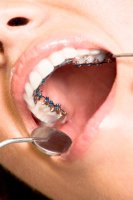 Физиологические изменения в зубочелюстной системе при воздействии ортодонтических аппаратов