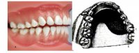 Биоморфологические изменения в зубочелюстной системе при воздействии ортодонтических аппаратов