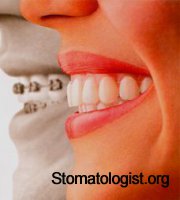 Реактивные изменения слизистой оболочки при воздействии ортодонтических аппаратов