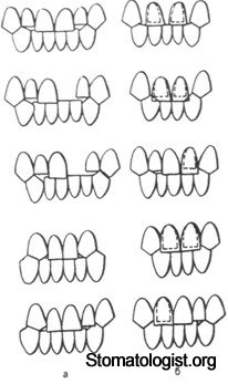 Повреждение временных и постоянных зубов