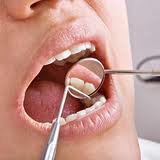 Тортопозиция зубов