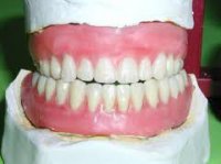 Устранение аномалий положения зубов, нарушений формы и размеров зубных дуг