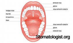 Классификация заболеваний слизистой оболочки полости рта