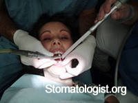 Пломбирование зубов различными материалами