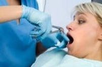 Удаление зубов щипцами
