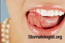 Контроль здоровья полости рта